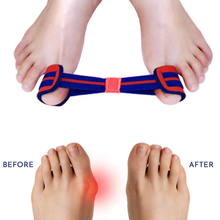 Load image into Gallery viewer, Generise Bunion Exerciser