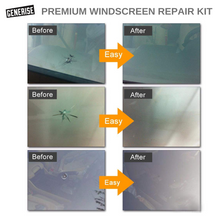 Load image into Gallery viewer, Generise PREMIUM Windshield Repair Kit